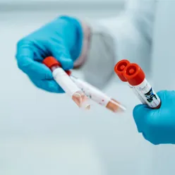 En person med hansker og en blå hanske som holder en sprøyte