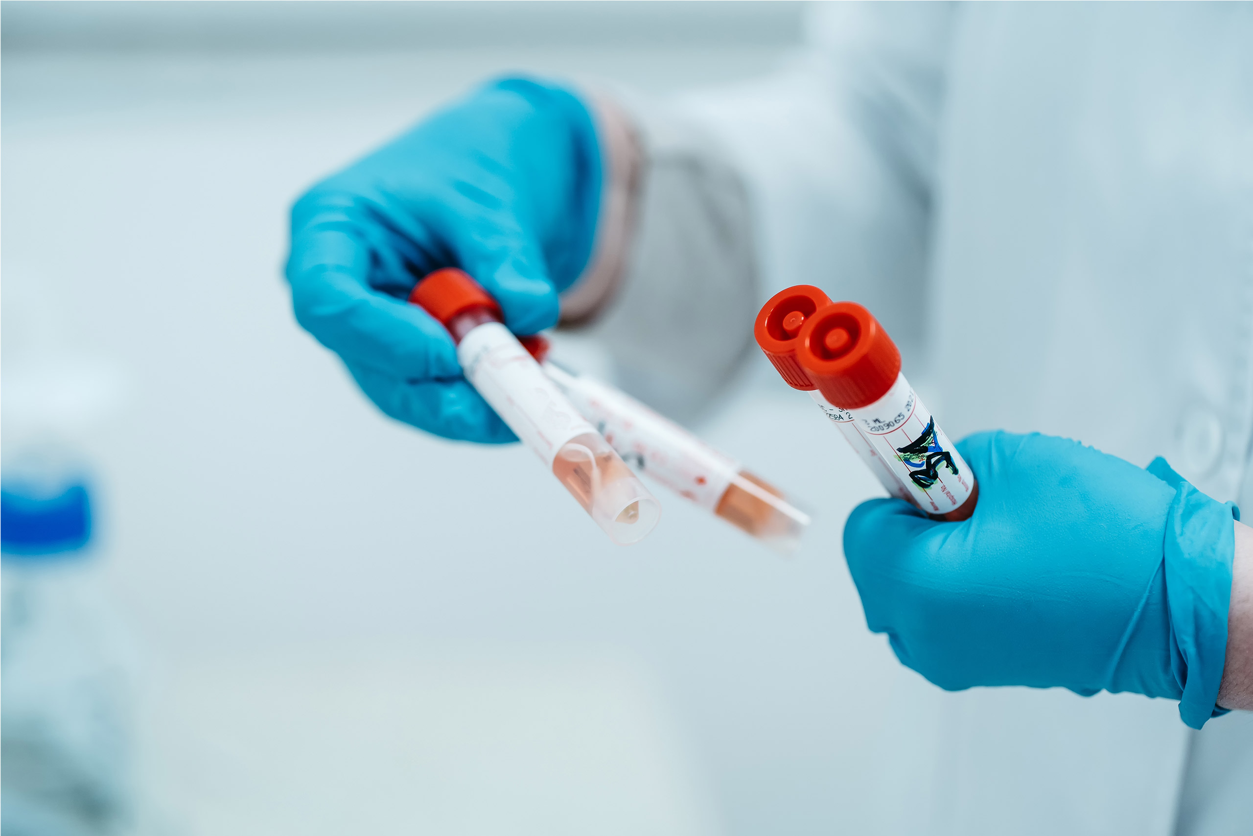 En person med hansker og en blå hanske som holder en sprøyte